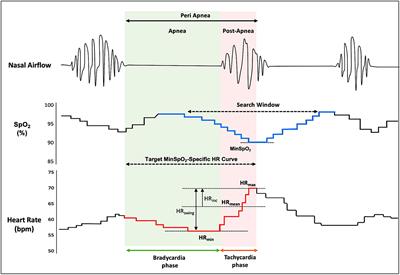 The Nadir Oxygen-Specific Heart Rate Response in Sleep Apnea Links With the Occurrence of Acute Myocardial Infarction